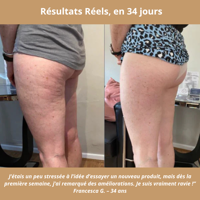 GlowLift — Le masseur qui Tonifie, draine, raffermit – et réconcilie-vous avec votre peau.