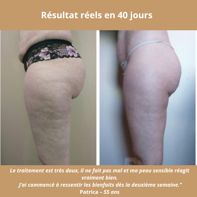 GlowLift — Le masseur qui Tonifie, draine, raffermit – et réconcilie-vous avec votre peau.
