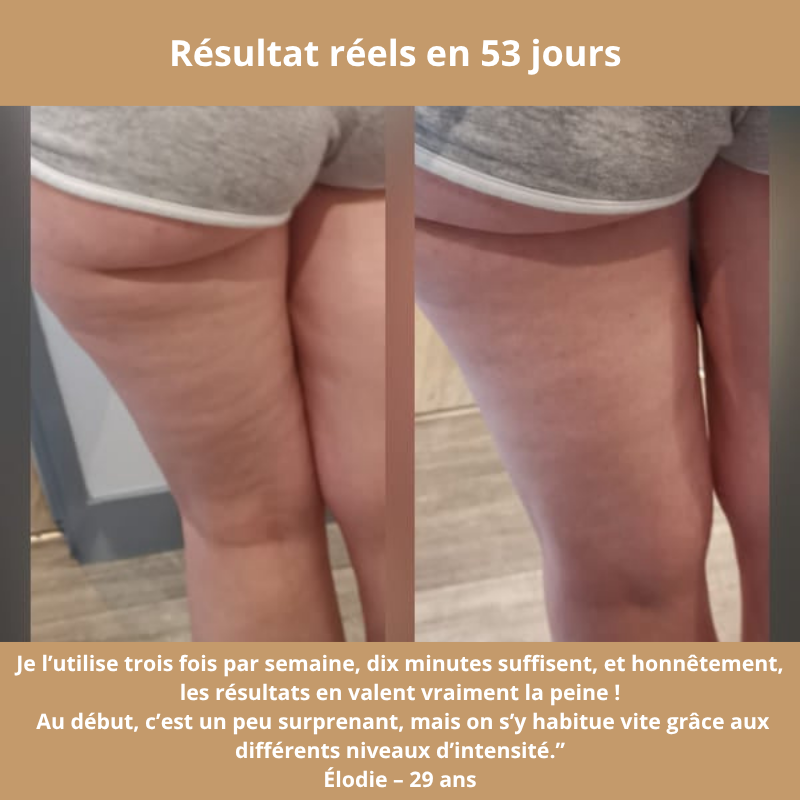 GlowLift — Le masseur qui Tonifie, draine, raffermit – et réconcilie-vous avec votre peau.